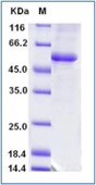 DLST Recombinant Protein